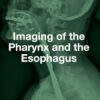 Imaging of the Pharynx and the Esophagus (EPUB)