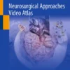Neurosurgical Approaches Video Atlas :