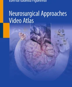Neurosurgical Approaches Video Atlas :