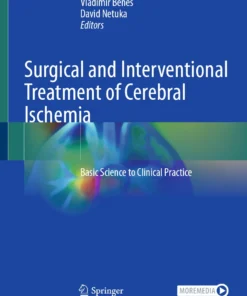 Surgical and Interventional Treatment of Cerebral Ischemia : Basic Science to Clinical Practice
