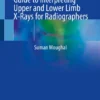 Fracture Finder: A Practical Guide to Interpreting Upper and Lower Limb X-Rays for Radiographers