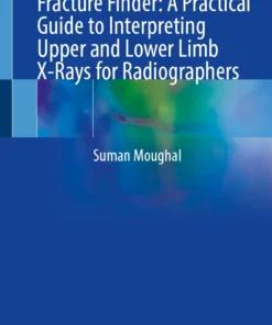 Fracture Finder: A Practical Guide to Interpreting Upper and Lower Limb X-Rays for Radiographers