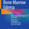 Bone Marrow Edema : Forms, Pathogenesis, Diagnosis, and Therapy