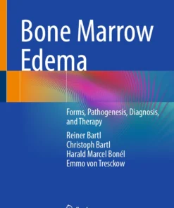 Bone Marrow Edema : Forms, Pathogenesis, Diagnosis, and Therapy