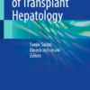 Fundamentals of Transplant Hepatology :