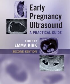 Early Pregnancy Ultrasound: A Practical Guide, 2nd edition (PDF)