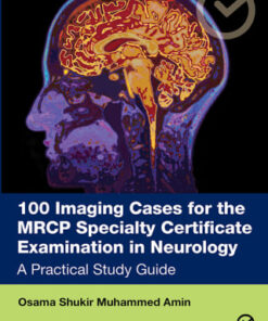 100 Imaging Cases for the MRCP Specialty Certificate Examination in Neurology (EPUB)