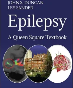 Epilepsy: A Queen Square Textbook (PDF)