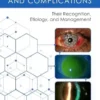 Scleral Lens Issues and Complications (EPUB) Scleral Lens Issues and Complications (EPUB)