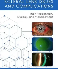 Scleral Lens Issues and Complications (EPUB)
