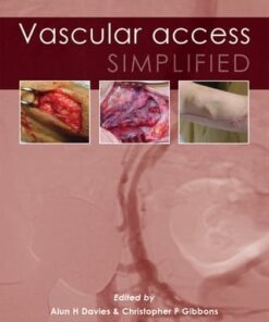 Vascular Access Simplified, 2nd Edition (EPUB)