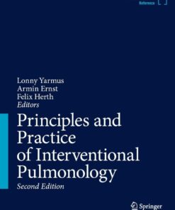 Principles and Practice of Interventional Pulmonology, 2026th Edition (EPUB)