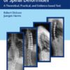 Modern Management of Spinal Deformities (EPUB) Modern Management of Spinal Deformities (EPUB)