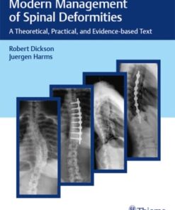 Modern Management of Spinal Deformities (EPUB)