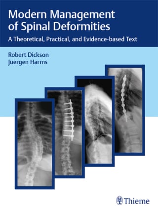 Modern Management of Spinal Deformities (EPUB) Modern Management of Spinal Deformities (EPUB)