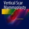 Vertical Scar Mammaplasty, 2nd Edition (PDF)