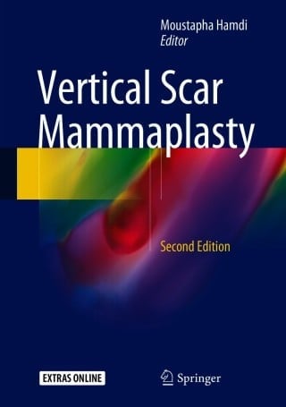 Vertical Scar Mammaplasty, 2nd Edition (PDF) Vertical Scar Mammaplasty, 2nd Edition (PDF)
