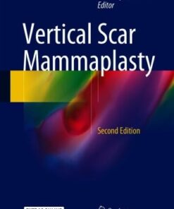 Vertical Scar Mammaplasty, 2nd Edition (EPUB)