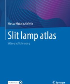 Slit lamp atlas, 2025th Edition (PDF)