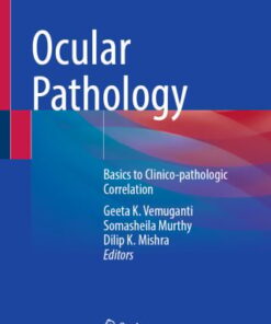 Ocular Pathology (EPUB)