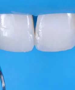 OHI-S Aesthetic Dentistry Congress in Milan Difficult cases in esthetic dentistry