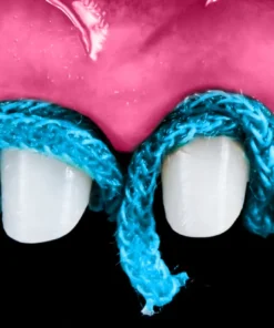 OHI-S Aesthetic Evolution