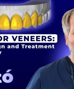 OHI-S Anterior Veneers Smile Design and Treatment Planning by Jan Hajtó