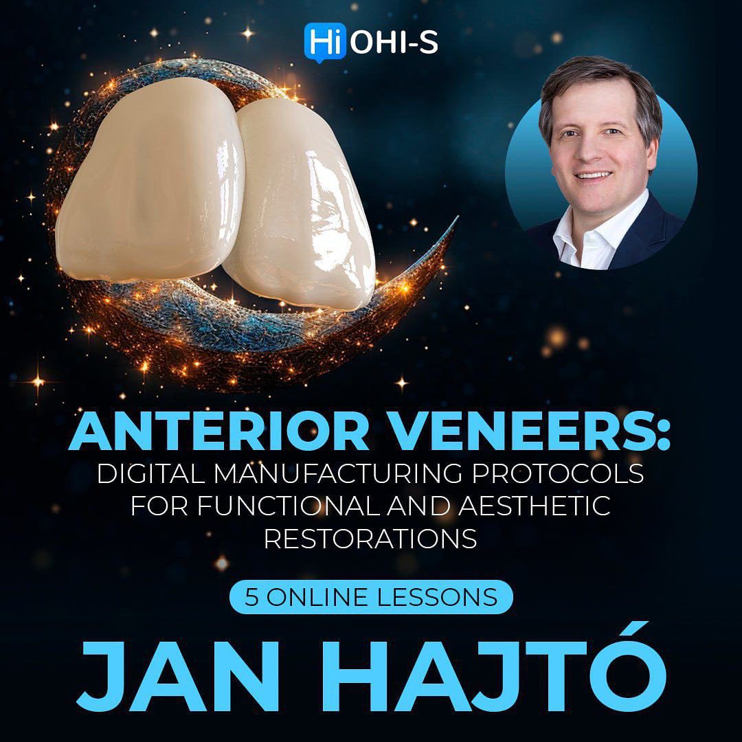 OHI-S Anterior veneers digital manufacturing protocols for functional and aesthetic restorations