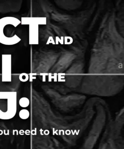 OHI-S CBCT and MRI of the TMJ everything you need to know