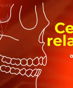 OHI-S Centric relation all methods of registration and clinical application