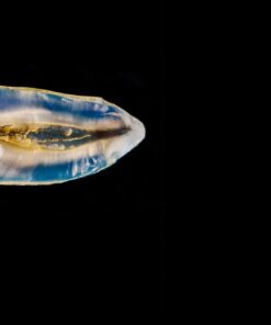 OHI-S Ceramic restorations