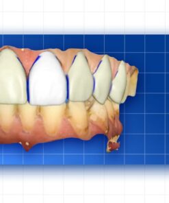OHI-S Complete prosthetic protocols CADCAM CEREC
