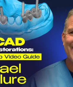 OHI-S EXOCAD Implant Restorations Step-by-step Video Guide
