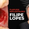 OHI-S Flapless implantology protocols for immediate implant placement and loading