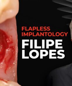 OHI-S Flapless implantology protocols for immediate implant placement and loading