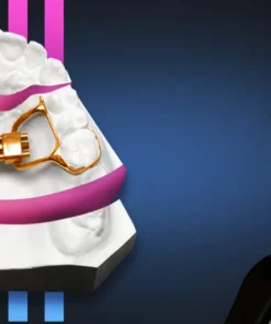 OHI-S Functional orthodontics. Autotransplantation. Result retention