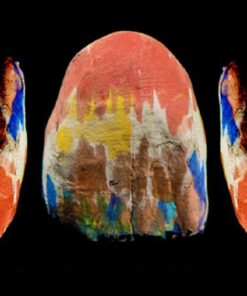 OHI-S Fundamental principles of aesthetics in dentistry dental, gingual and facial aesthetics 2021