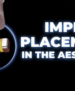 OHI-S Implant placement in the aesthetic zone steps and techniques