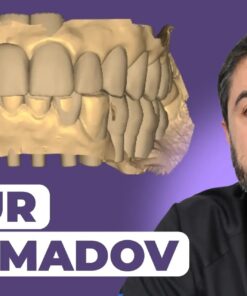 OHI-S La chaîne numérique dans la réhabilitation orale