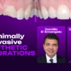 OHI-S Minimally Invasive Aesthetic Restorations Additive, Digital, and Fully Functional Rehabilitation OHI-S Minimally Invasive Aesthetic Restorations Additive, Digital, and Fully Functional Rehabilitation