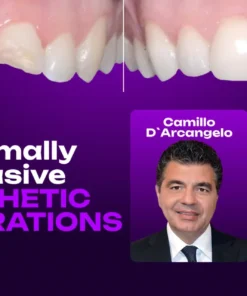OHI-S Minimally Invasive Aesthetic Restorations Additive, Digital, and Fully Functional Rehabilitation