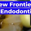 OHI-S New Frontiers in Endodontics Guide to Predictable Practice OHI-S New Frontiers in Endodontics Guide to Predictable Practice