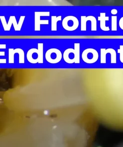 OHI-S New Frontiers in Endodontics Guide to Predictable Practice