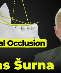OHI-S Spherical Occlusion Theory for Dentists and Dental Technician Team