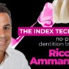 OHI-S The Index Technique. No-prep worn dentition treatment