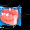OHI-S Veneers, inlay, onlay, crowns full protocols OHI-S Veneers, inlay, onlay, crowns full protocols