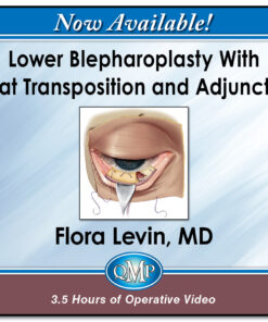 Quality Medical Publishing Lower Blepharoplasty With Fat Transposition and Adjuncts 2026