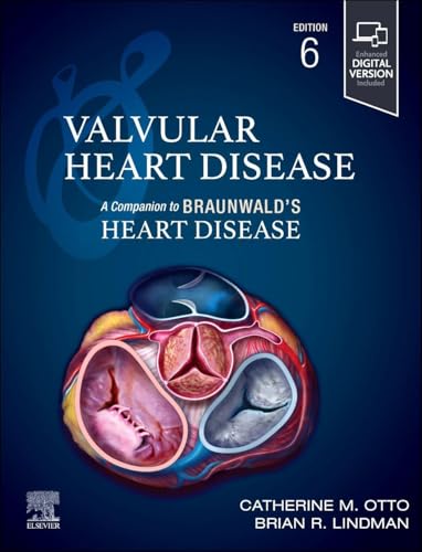 Valvular Heart Disease: A Companion to Braunwald’s Heart Disease, 6th edition (EPUB) Valvular Heart Disease: A Companion to Braunwald’s Heart Disease, 6th edition (EPUB)