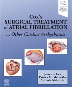 Cox’s Surgical Treatment of Atrial Fibrillation (EPUB)