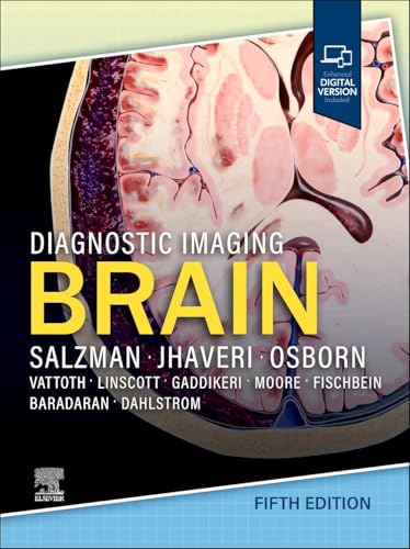 Diagnostic Imaging: Brain, 5th edition (PDF) Diagnostic Imaging: Brain, 5th edition (PDF)